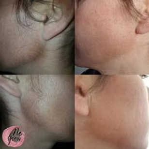 No Grow Female Facial Permanent Hair Remover